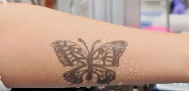 Ученые разработали нано-татуировку, которая будет сообщать о неполадках со здоровьем - Фото