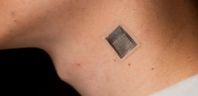 Ученые создали наклейку, которая может делать осмотр под кожей. Это поможет в лечении рака - Фото