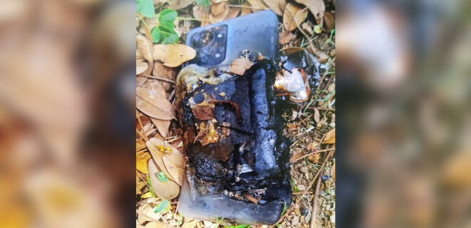 OnePlus Nord 2T взорвался в кармане у парня. Он попал в больницу – фото - Фото