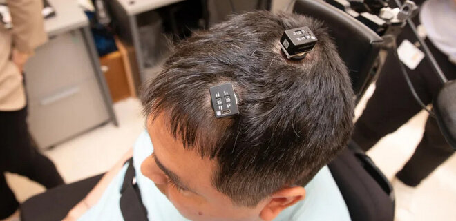 Вчені відновили чутливість паралізованому чоловікові за допомогою мозкових чипів – відео - Фото